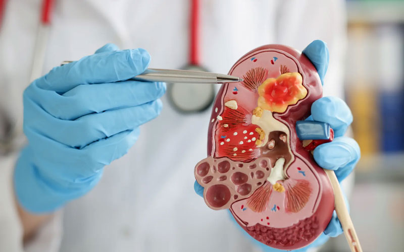 Kidney